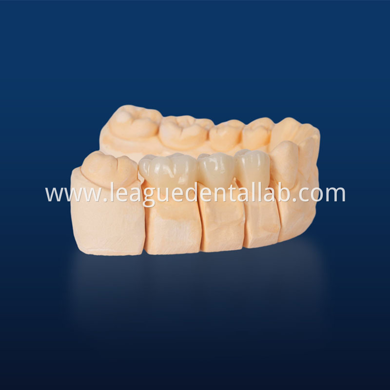 UTML zirconia,Katana zirconia,Esthetic zirconia,SHTML zirconia,3D Multilayered Zirconia
